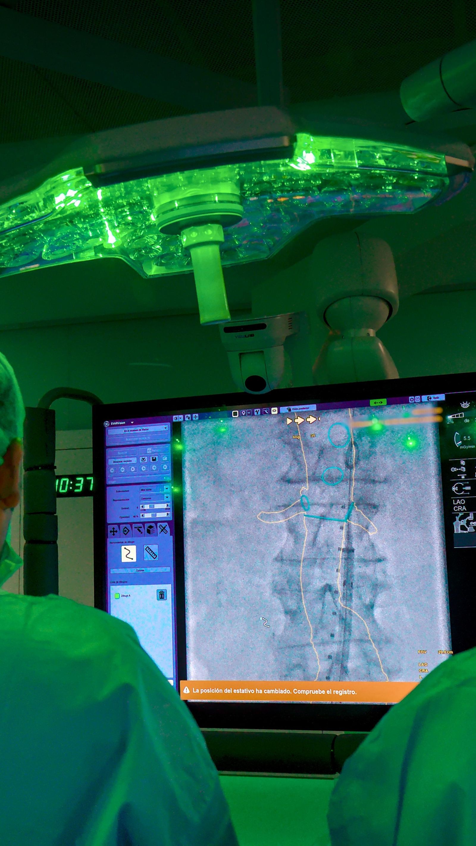 Detalle de uno de los monitores que sirven de guía al cirujano.