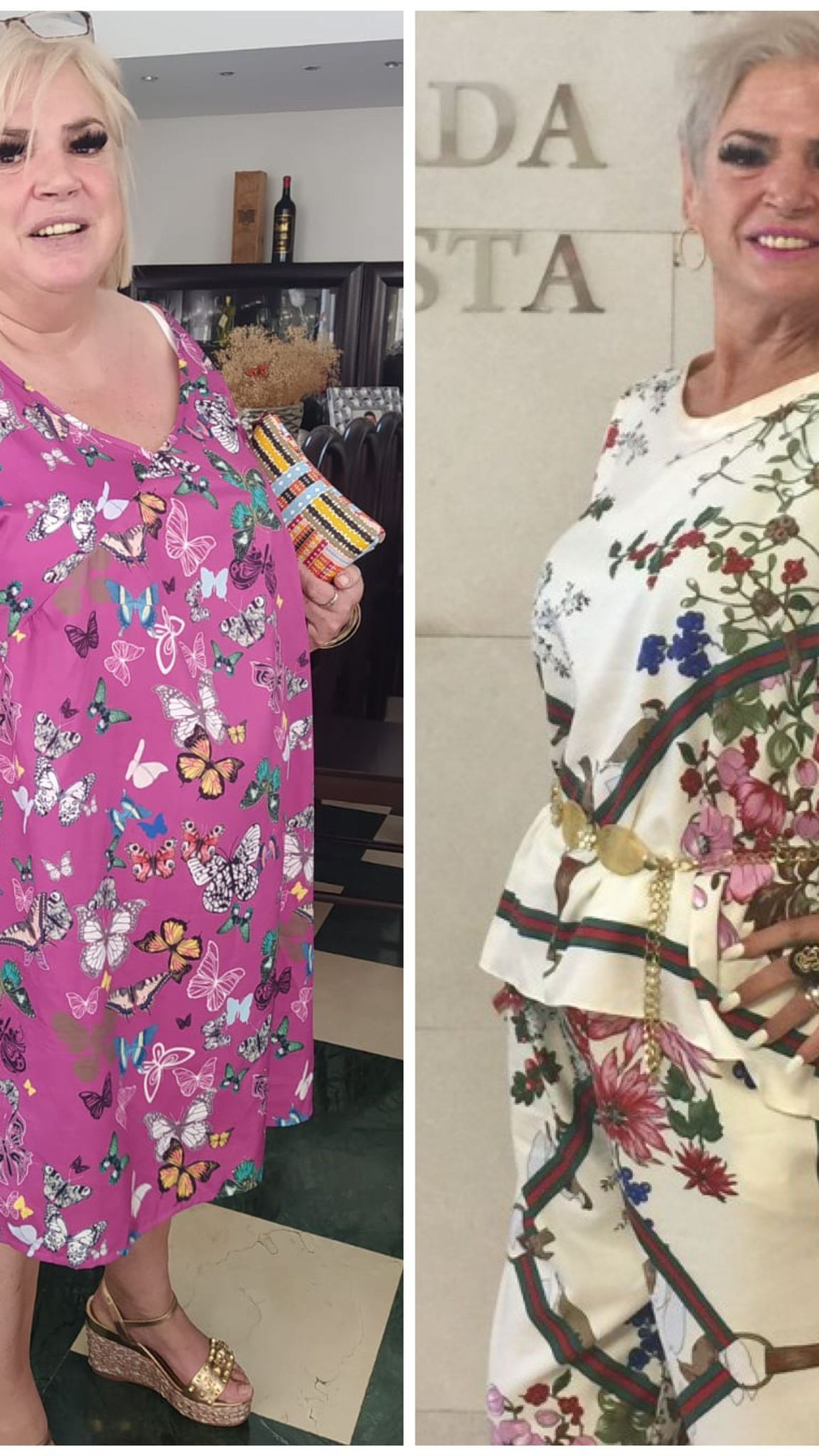 Cambio de Mari Carmen tras la operación