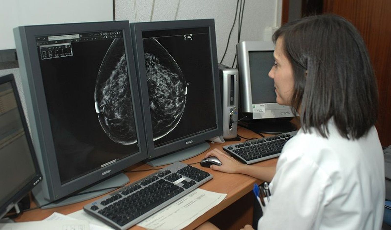 Cribado de cáncer de mama.