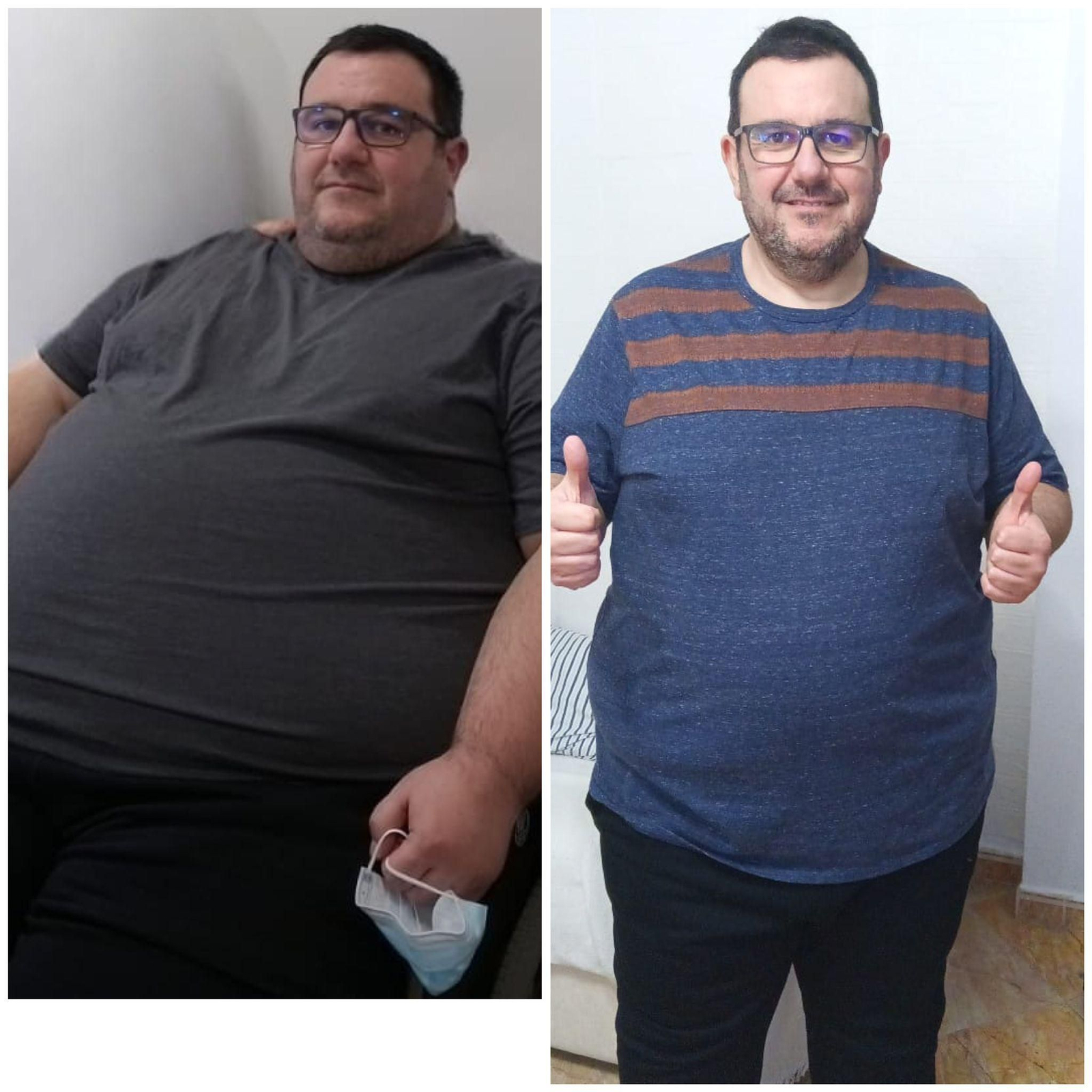 Eduardo antes y después de ser operado de obesidad