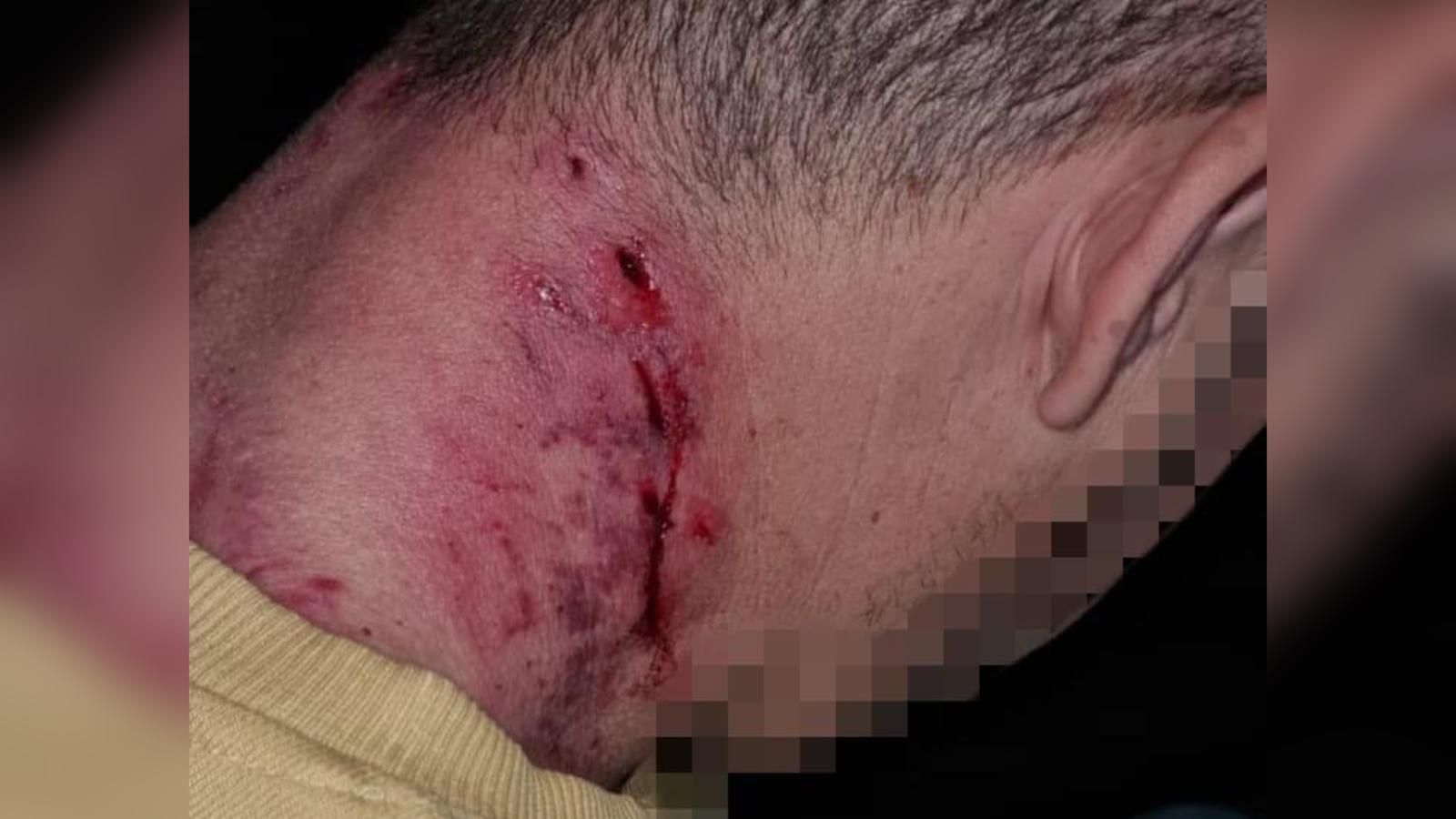 Persona herida por el ataque del perro.